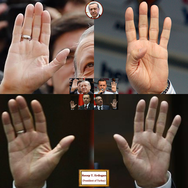 The hands of president of Turkey Recep Tayyip Erdogan: photo impressions.