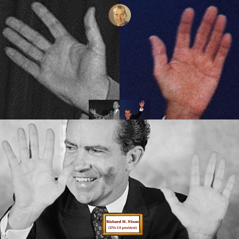 37nd US president Richard Nixon: hand shape impressions.